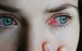 Conjunctivitis Causes And Symptoms