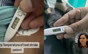 Heat Stroke Temperature High Advice Monika Langeh