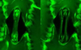 Plants Breathe Real Time