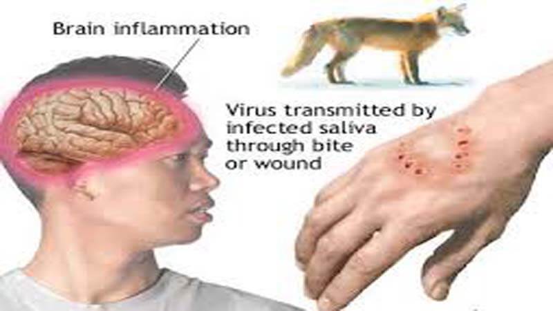 Encephalitis In Bihar