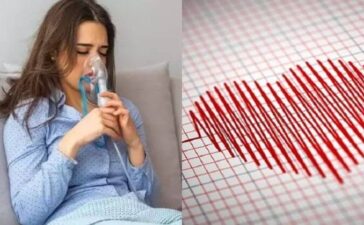 Heart Check-Up Post COVID-19