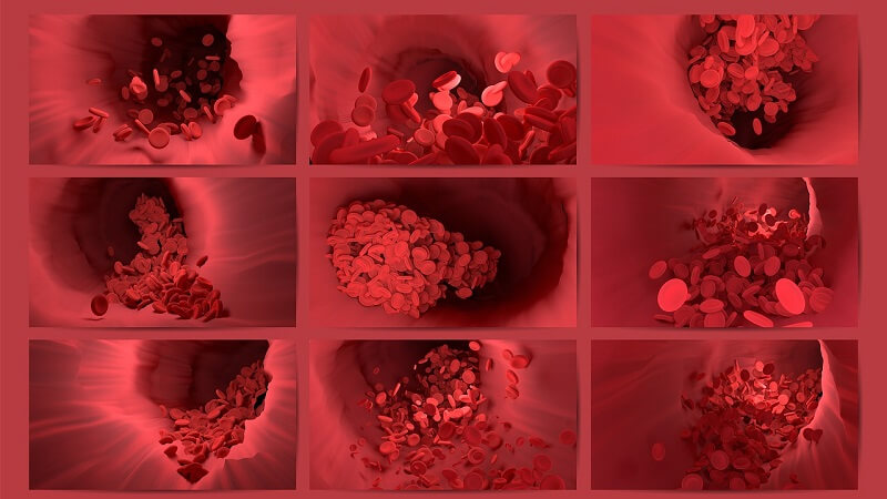 blood clot thrombosis