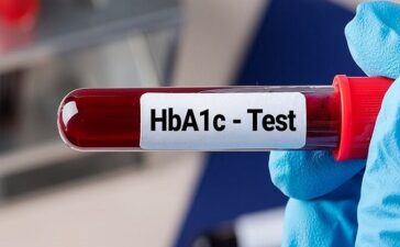 Glycosylated Haemoglobin Test