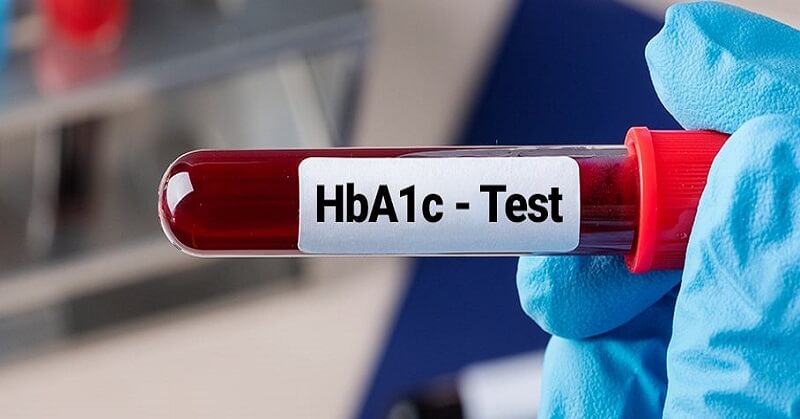Glycosylated Haemoglobin Test